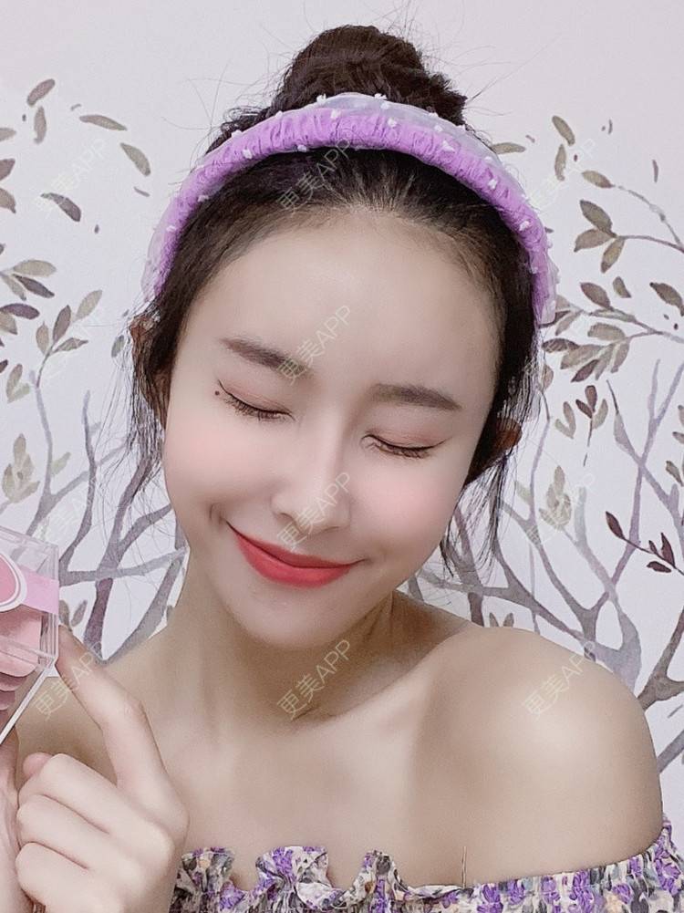 更美 - 更美用户sPJ9VN1o87的自体脂肪面部年轻化经验 | 视频日记 | 自体脂肪面部年轻化 | 天津