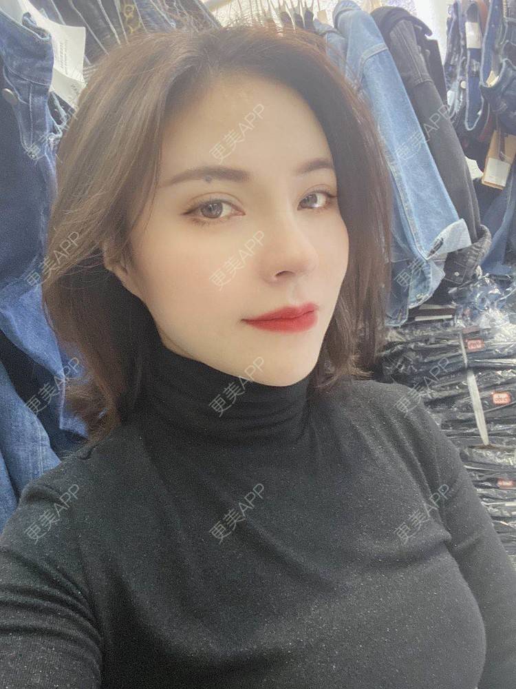 更美 - 更美用户cYoCneHuFl的鼻部多项经验 | 阳江 | 鼻部多项