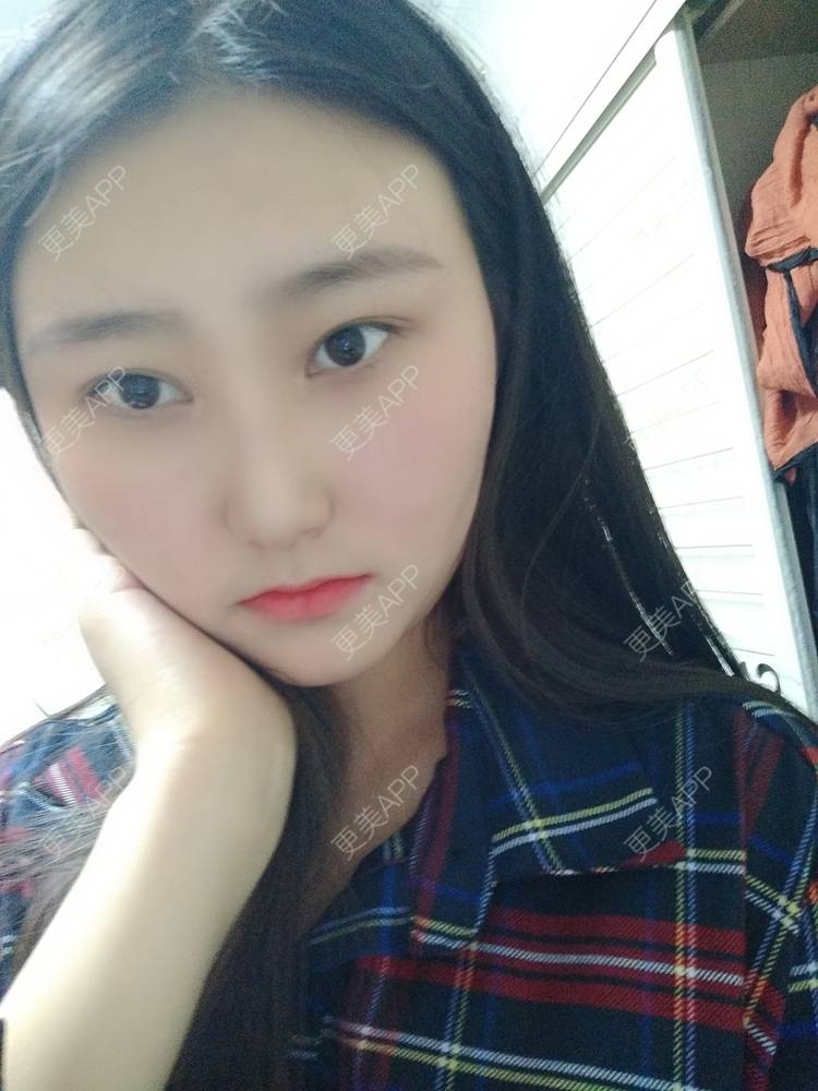 更美 - 更美用户zLnEttFeDx的热玛吉经验 | 广州 | 热玛吉