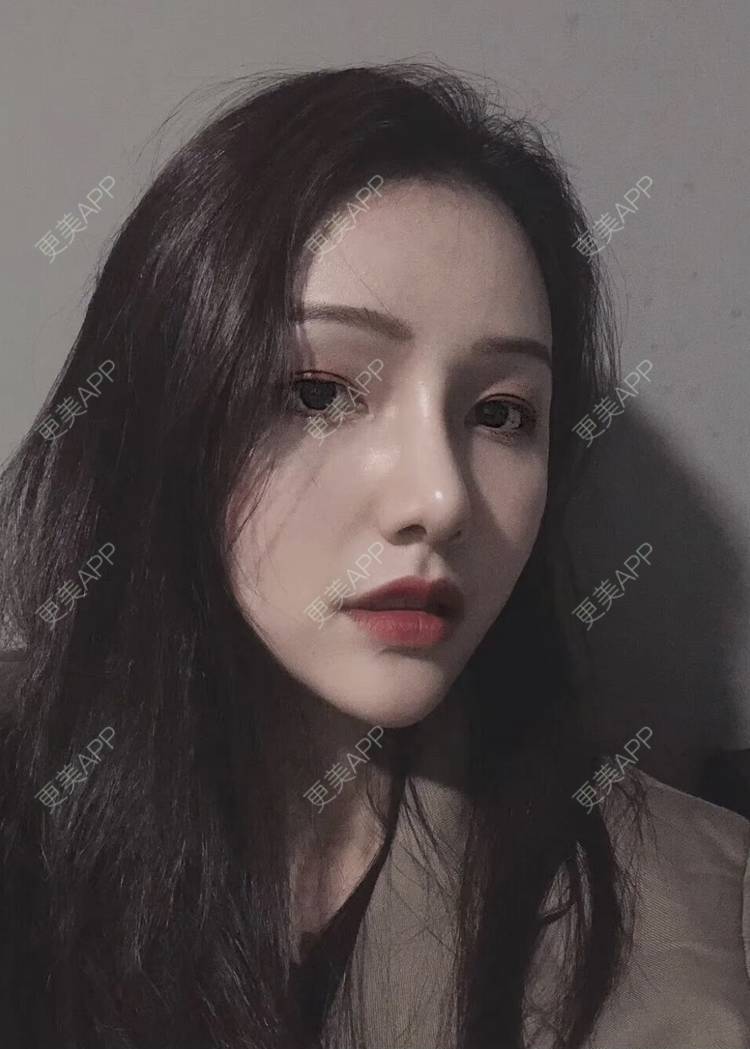 更美 - 路西佛的鼻部多项经验 | 鼻部多项 | 长沙