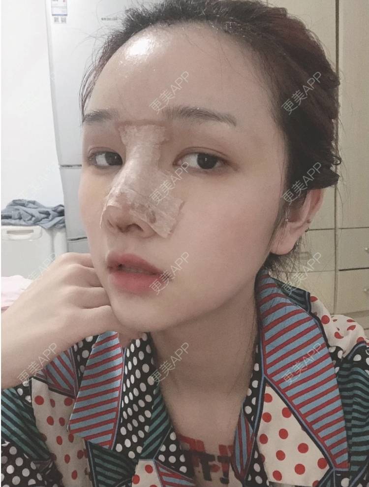 更美 - 路西佛的鼻部多项经验 | 鼻部多项 | 长沙