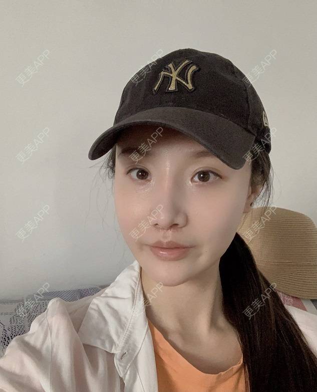 更美 - 更美用户DLi7HL09O1的人中缩短经验 | 人中缩短 | 广州