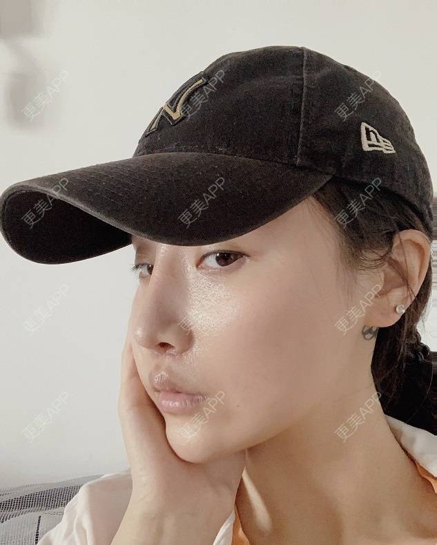 更美 - 更美用户DLi7HL09O1的人中缩短经验 | 人中缩短 | 广州