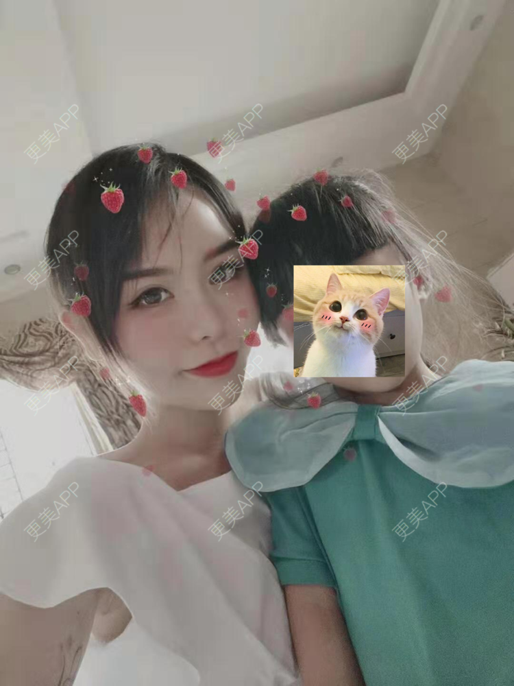 更美 - 猫耳朵的生活的自体脂肪填充法令纹经验 | 自体脂肪填充法令纹 | 自体脂肪隆胸 | 深圳 | 超声溶脂瘦手臂 | 超声溶脂瘦腹部 | 超声溶脂瘦背部