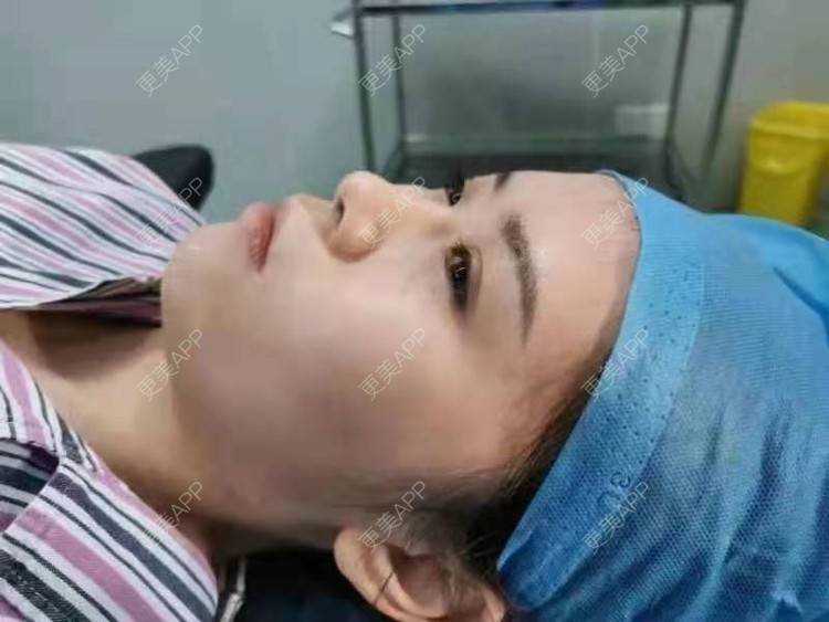 更美 - gc19841213的隆鼻经验 | 隆鼻 | 开外眼角 | 上海