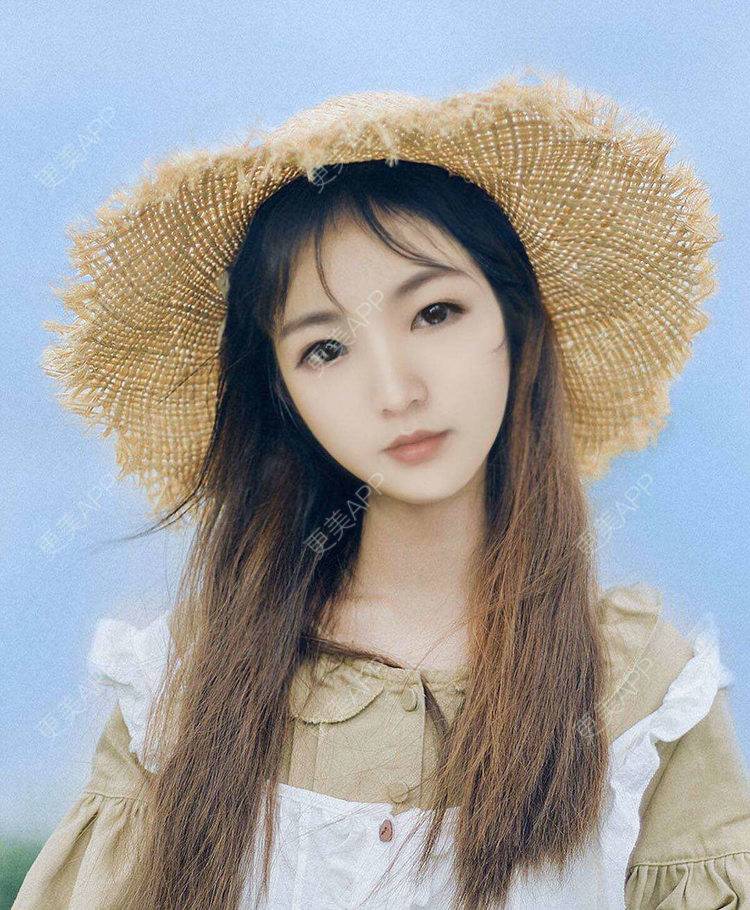 更美 - ALittle芸豆的隆鼻经验 | 广州 | 视频日记 | 隆鼻