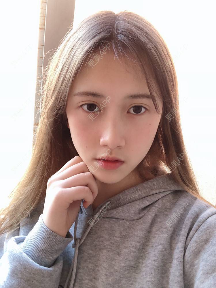 更美 - 更美用户ezaery6fSs的眼部多项经验 | 眼部多项 | 广州 | 视频日记