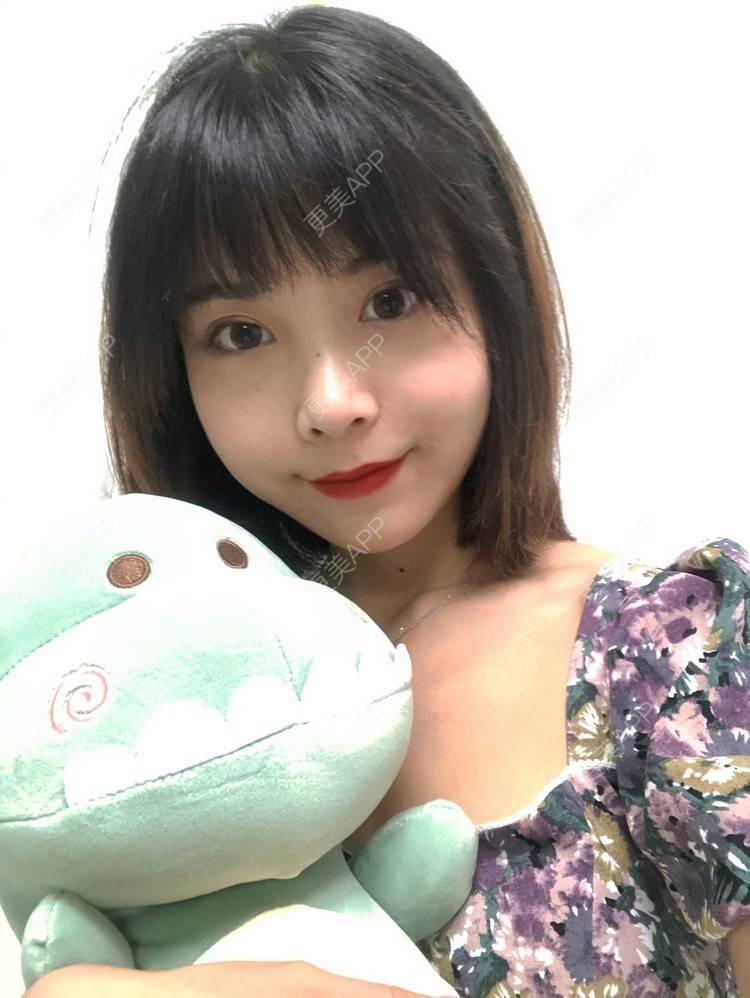 更美 - 更美用户qGSX4259xW的定点双眼皮经验 | 成都 | 视频日记 | 定点双眼皮