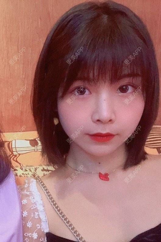 更美 - 更美用户qGSX4259xW的定点双眼皮经验 | 成都 | 视频日记 | 定点双眼皮