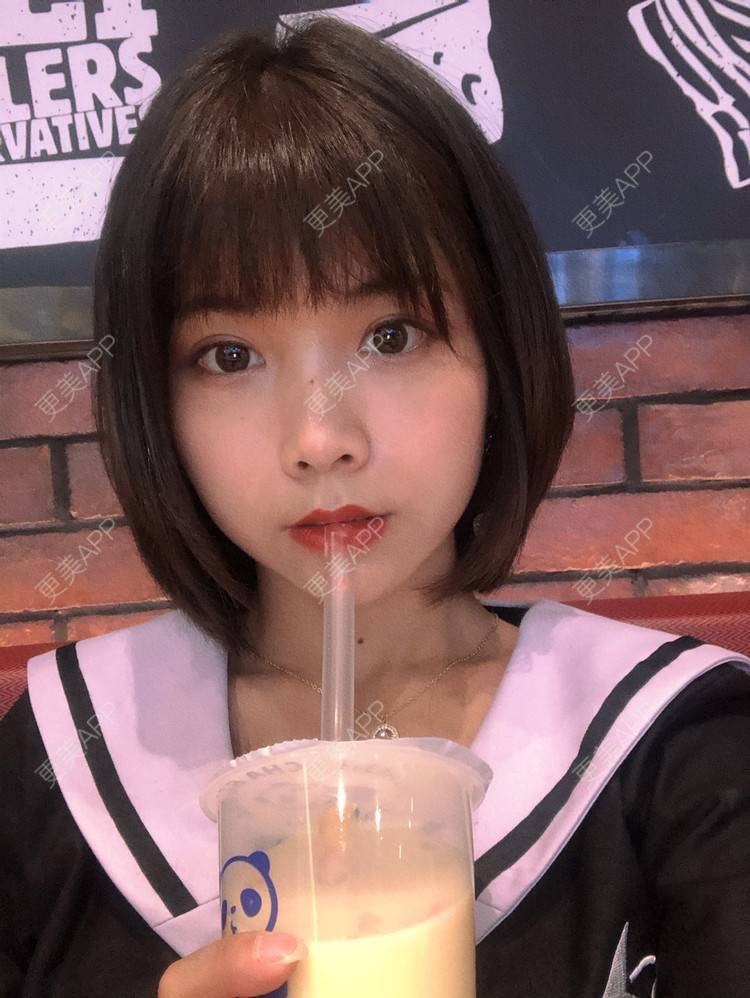 更美 - 更美用户qGSX4259xW的定点双眼皮经验 | 成都 | 视频日记 | 定点双眼皮