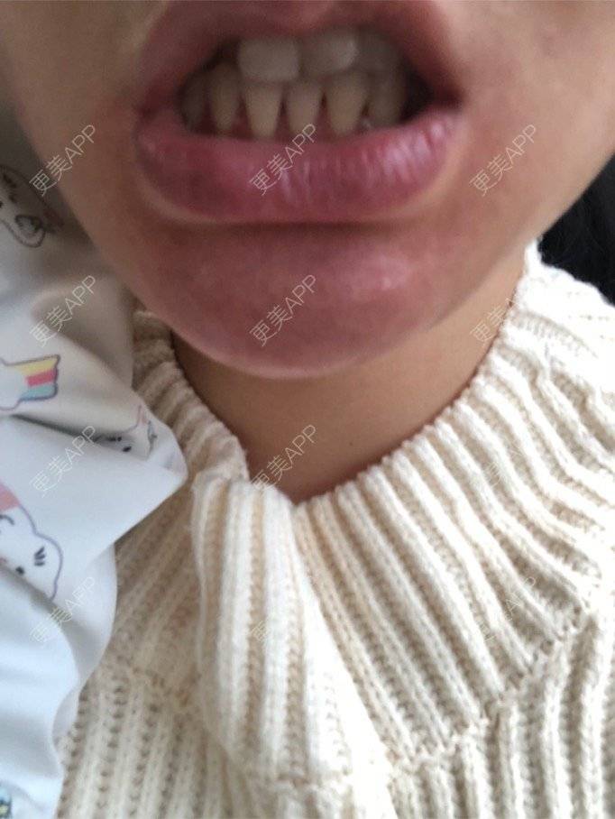 更美 - 更美用户KypVf5ovVE的经验 | 上海