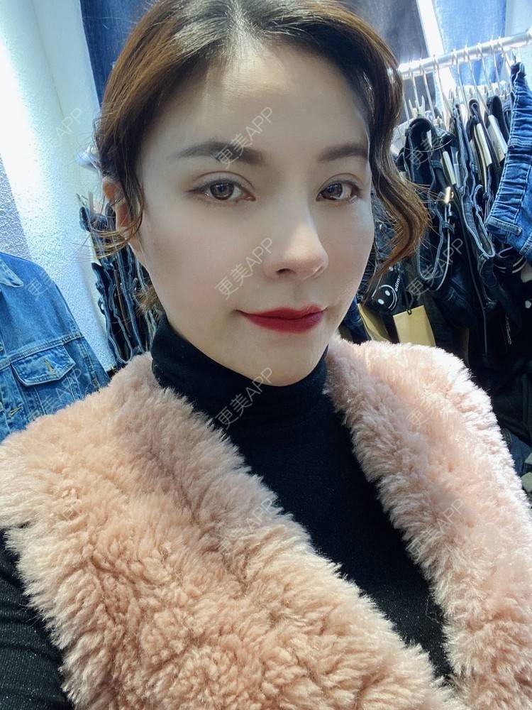 更美 - 更美用户cYoCneHuFl的鼻部多项经验 | 阳江 | 鼻部多项