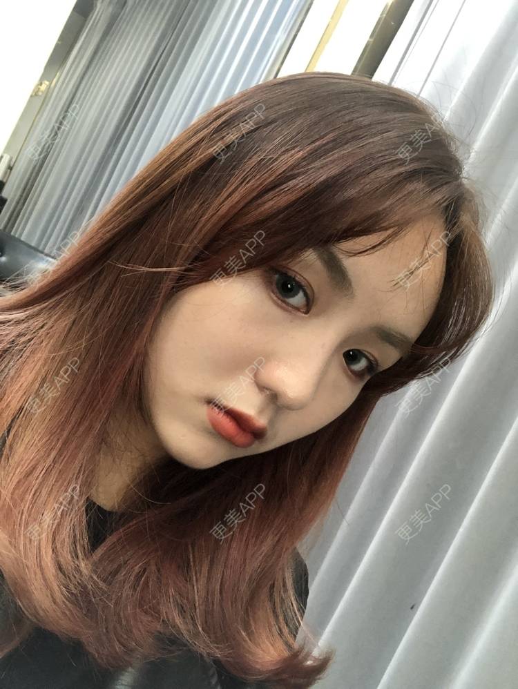 更美 - 更美用户aujlWhrgzx的鼻部多项经验 | 广州 | 鼻部多项