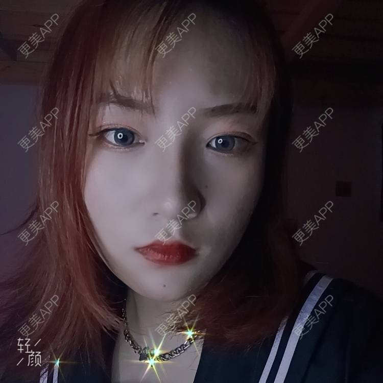 更美 - 更美用户tbs28rKiLZ的玻尿酸卧蚕经验 | 玻尿酸卧蚕 | 杭州
