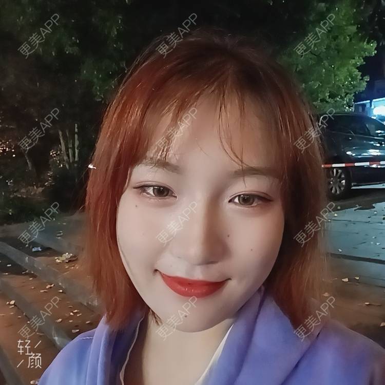 更美 - 更美用户tbs28rKiLZ的玻尿酸卧蚕经验 | 玻尿酸卧蚕 | 杭州