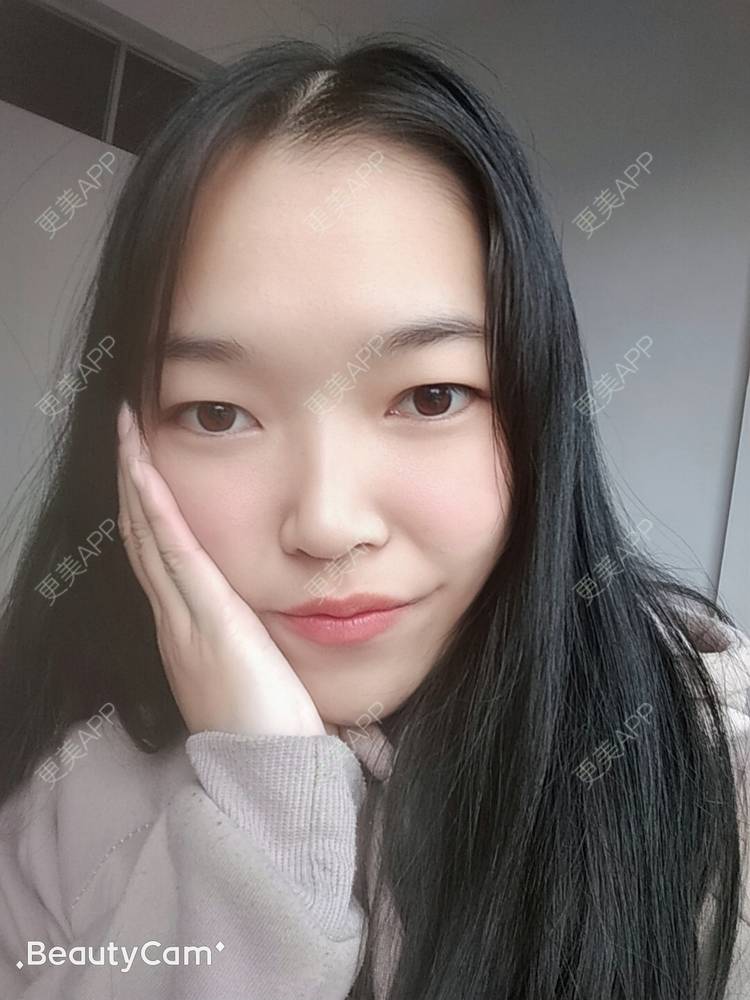 更美 - 更美用户d3VL5UQGsk的热拉提经验 | 上海 | 热拉提