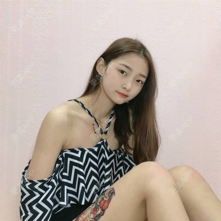 更美 - 更美用户VfaSXjhbLg的热玛吉经验 | 广州 | 热玛吉