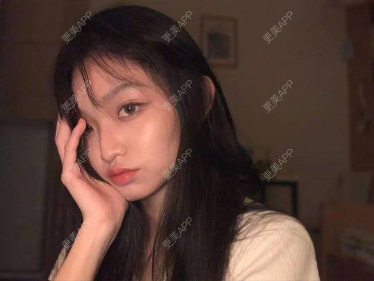 更美 - 就算心丢了也要爱你厥的肩部吸脂经验 | 北京 | 肩部吸脂