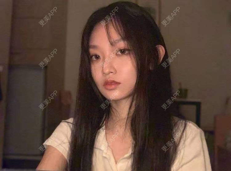 更美 - 就算心丢了也要爱你厥的肩部吸脂经验 | 北京 | 肩部吸脂