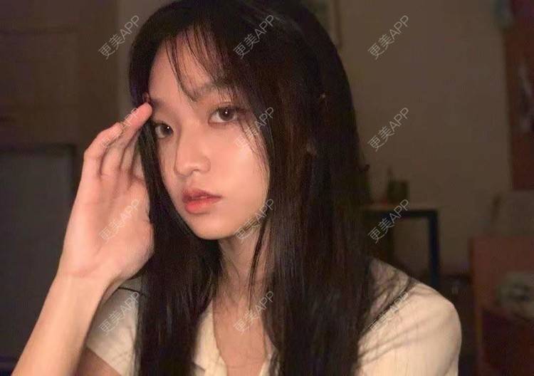 更美 - 就算心丢了也要爱你厥的肩部吸脂经验 | 北京 | 肩部吸脂
