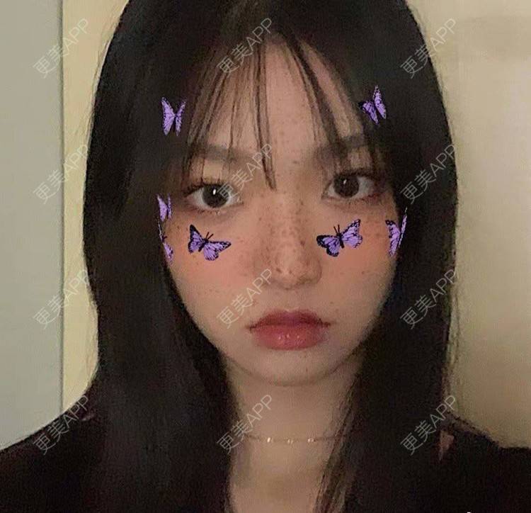 更美 - 就算心丢了也要爱你厥的肩部吸脂经验 | 北京 | 肩部吸脂