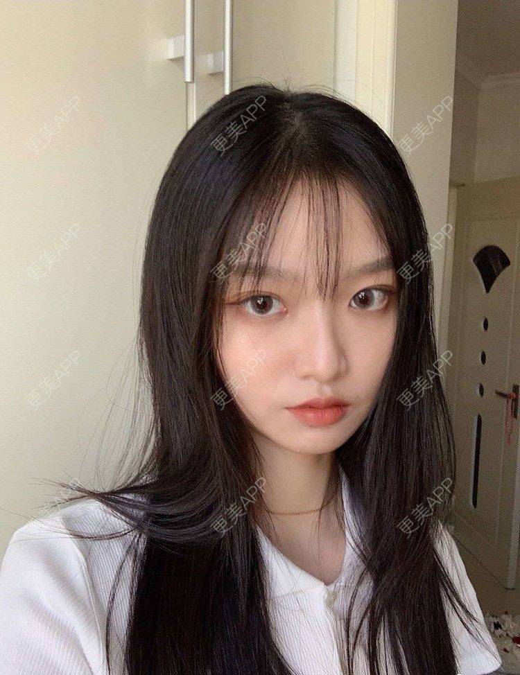 更美 - 就算心丢了也要爱你厥的肩部吸脂经验 | 北京 | 肩部吸脂