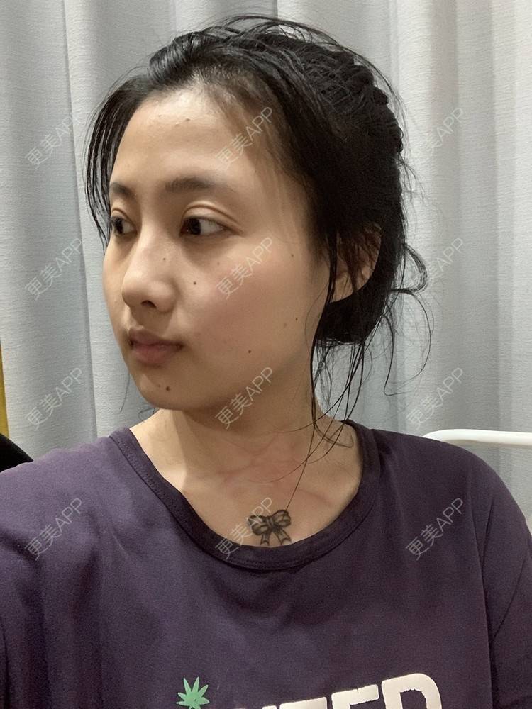 更美 - 情愛χμe徒直的综合淡疤经验 | 综合淡疤 | 注射淡疤 | 激光淡疤 | 成都