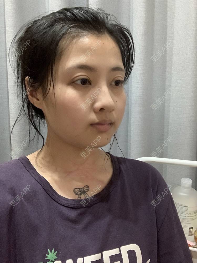 更美 - 情愛χμe徒直的综合淡疤经验 | 综合淡疤 | 注射淡疤 | 激光淡疤 | 成都