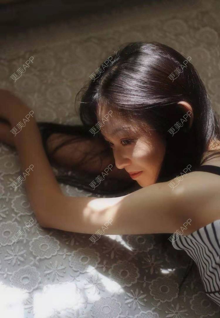 更美 - 就算心丢了也要爱你厥的肩部吸脂经验 | 北京 | 肩部吸脂