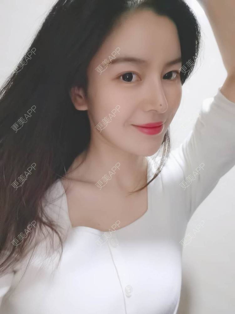 更美 - 金色的丝的鼻部多项经验 | 肋软骨隆鼻 | 自体肋软骨垫鼻基底 | 鼻部多项 | 鼻小柱延长 | 膨体隆鼻 | 武汉
