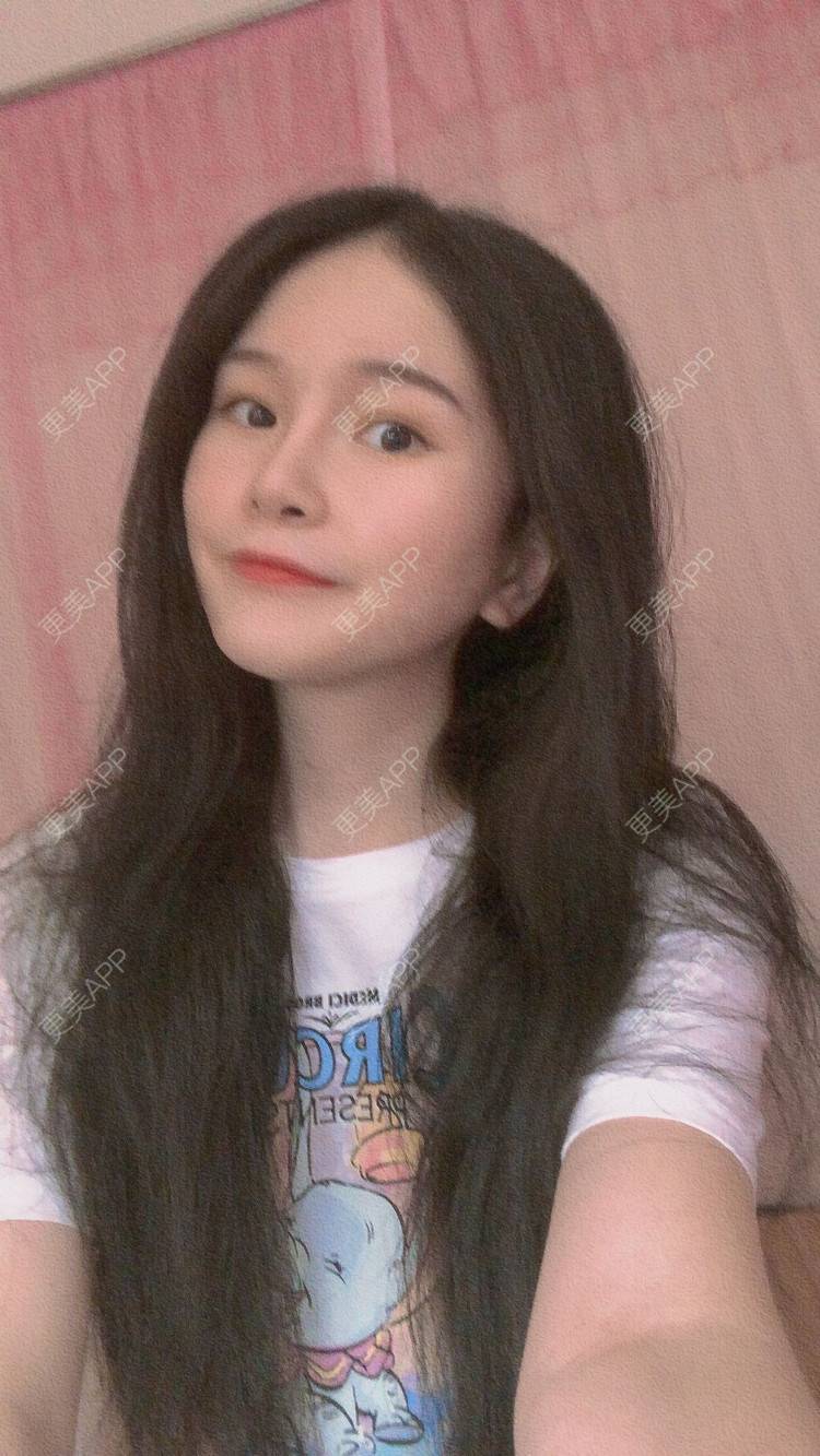 更美 - 更美用户1hOuWDVG0V的下颌角经验 | 成都 | 下颌角