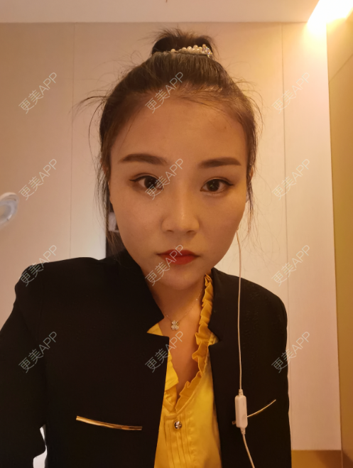 更美 - 更美用户wOARiRO1Ls的真皮丰卧蚕经验 | 北京 | 视频日记 | 真皮丰卧蚕