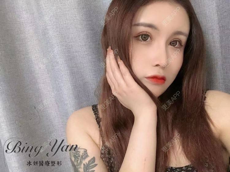 更美 - 祢的美丽/我的职责的开内眼角经验 | 肋软骨隆鼻 | 开内眼角 | 开外眼角 | 双眼皮修复 | 眼部多项 | 上海