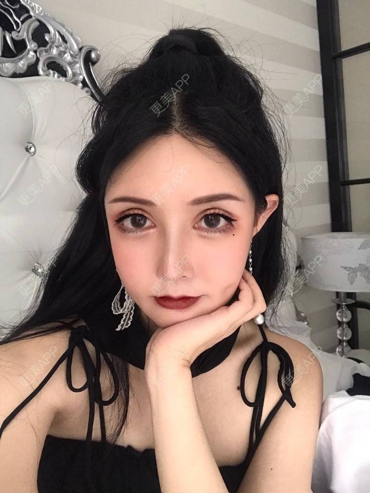 更美 - 八里飘香的经验 | 视频日记 | 隆鼻 | 重庆