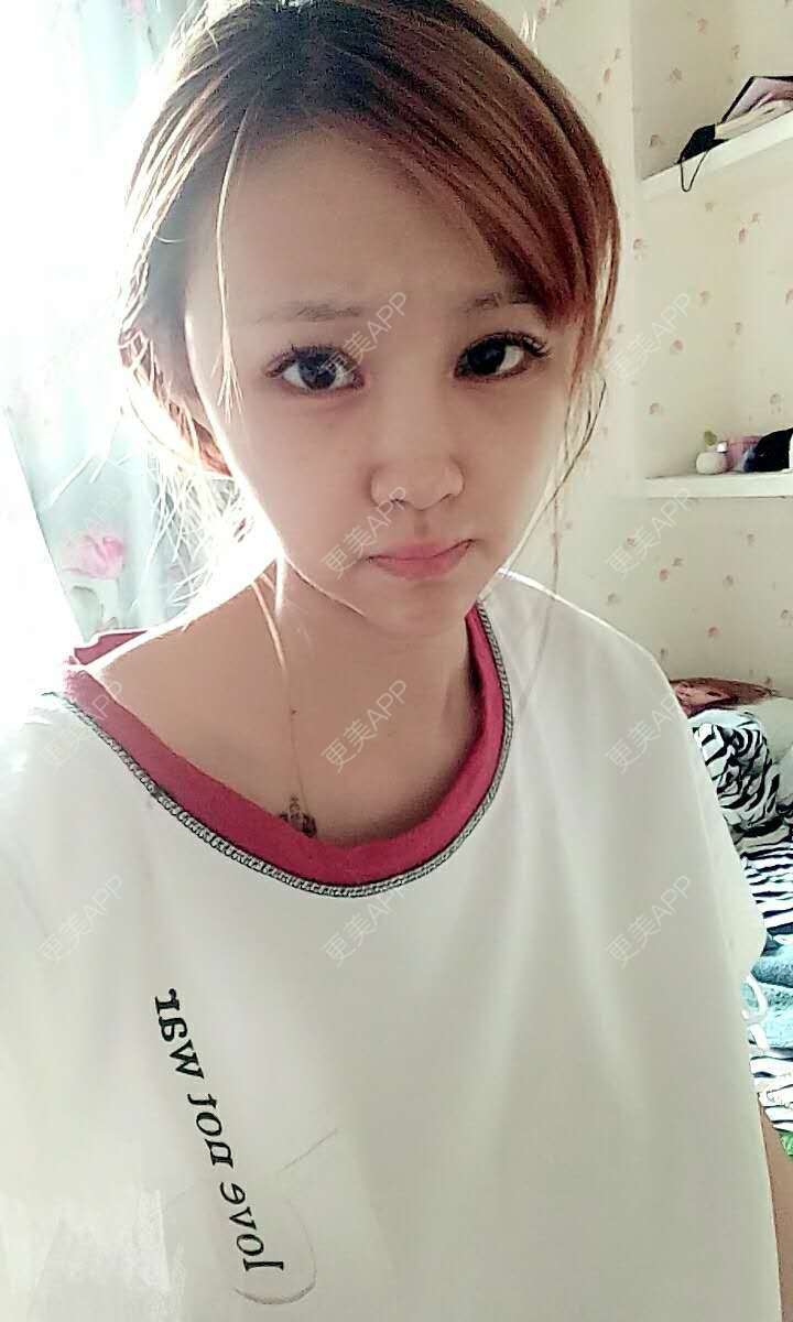 更美 - 八里飘香的经验 | 视频日记 | 隆鼻 | 重庆