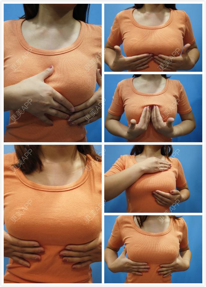 更美 - 南街爱人逝那托的假体隆胸日记 | 假体隆胸 | 美胸套餐 | 复合