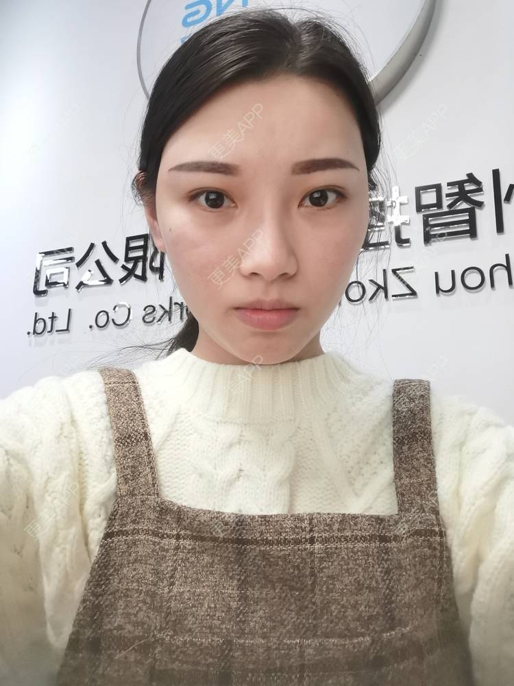 更美 - 更美用户82701801的隐形牙齿矫正经验 | 杭州