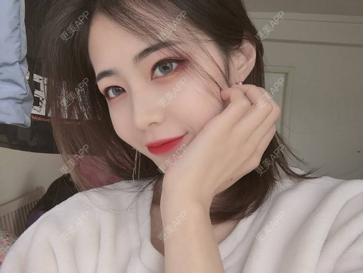 更美 - 飘啊飘啊飘的鼻部多项经验 | 杭州 | 鼻部多项
