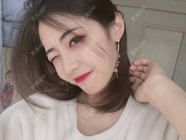 更美 - 飘啊飘啊飘的鼻部多项经验 | 杭州 | 鼻部多项