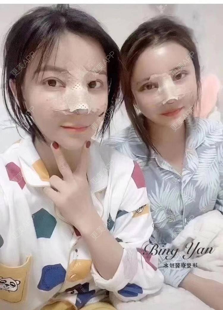 更美 - 祢的美丽/我的职责的肋软骨隆鼻经验 | 眼部多项 | 开眼角修复 | 双眼皮修复 | 肋软骨隆鼻 | 自体脂肪全面部填充 | 上海