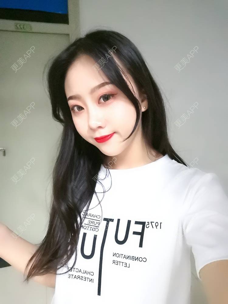 更美 - 更美用户vFETzv4uga的自体脂肪全面部填充经验 | 广州 | 自体脂肪全面部填充 | 视频日记