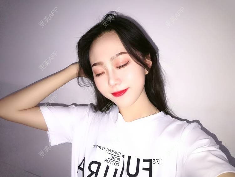 更美 - 更美用户vFETzv4uga的自体脂肪全面部填充经验 | 广州 | 自体脂肪全面部填充 | 视频日记