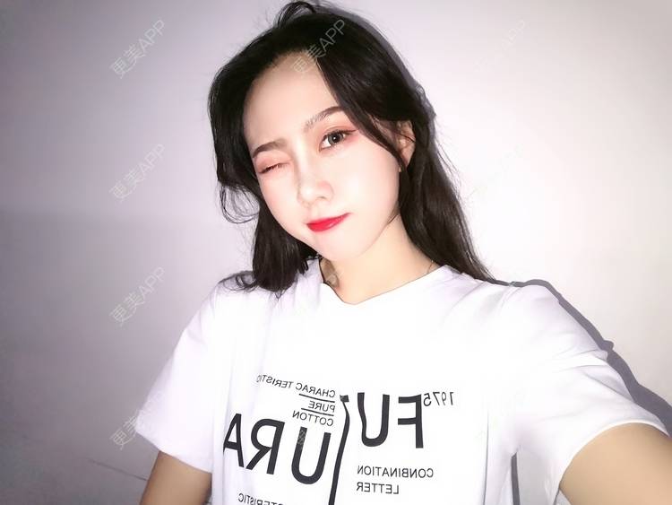 更美 - 更美用户vFETzv4uga的自体脂肪全面部填充经验 | 广州 | 自体脂肪全面部填充 | 视频日记