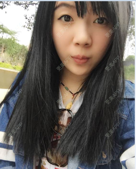 更美 - 更美用户EnzNtm7A5c的手术除腋臭经验 | 手术除腋臭