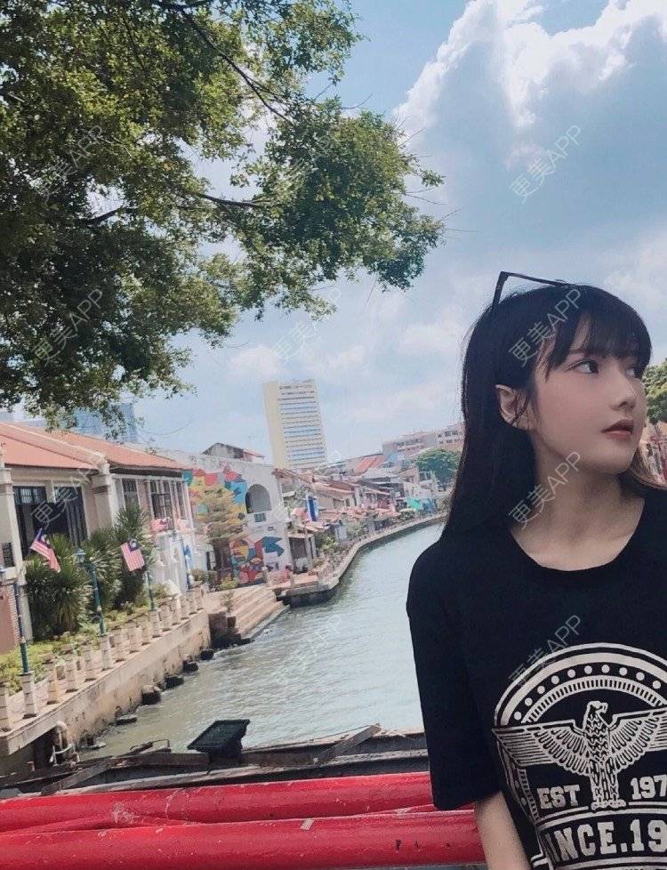 更美 - 婉青儿的凸嘴矫正经验 | 广州 | 凸嘴矫正 | 面部不对称矫正 | 视频日记