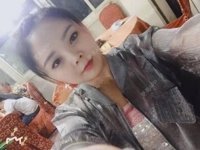更美 - 更美用户PVvylmTjJA的手臂吸脂经验 | 手臂吸脂 | 长沙