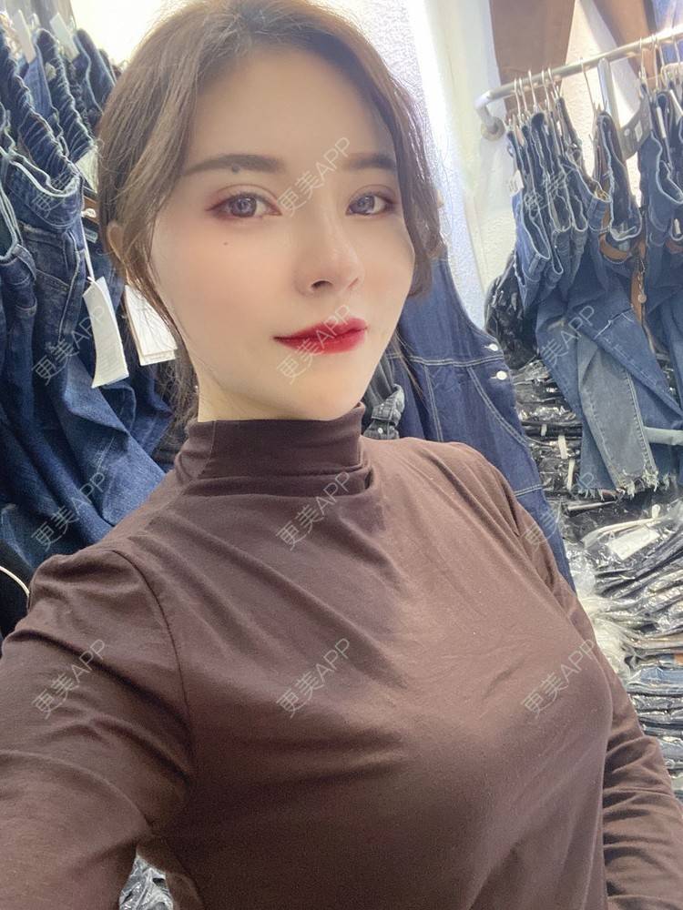 更美 - 更美用户cYoCneHuFl的鼻部多项经验 | 阳江 | 鼻部多项