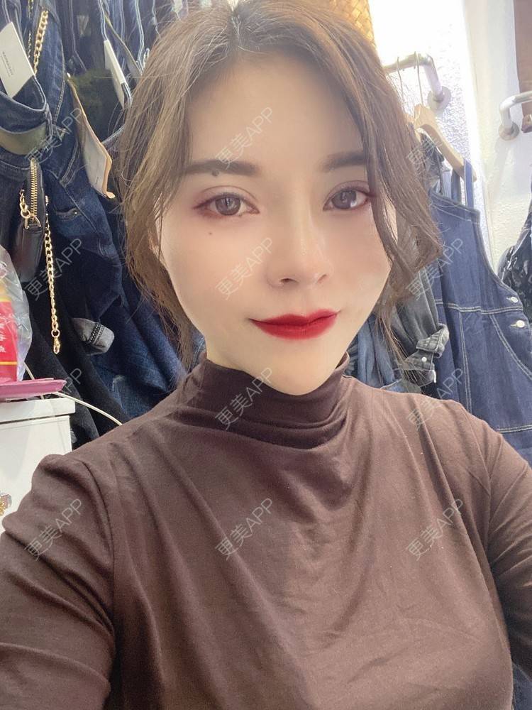 更美 - 更美用户cYoCneHuFl的鼻部多项经验 | 阳江 | 鼻部多项