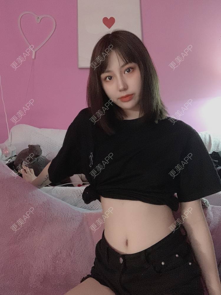 更美 - 生而往返的妊娠纹经验 | 成都 | 皮肤美容 | 妊娠纹