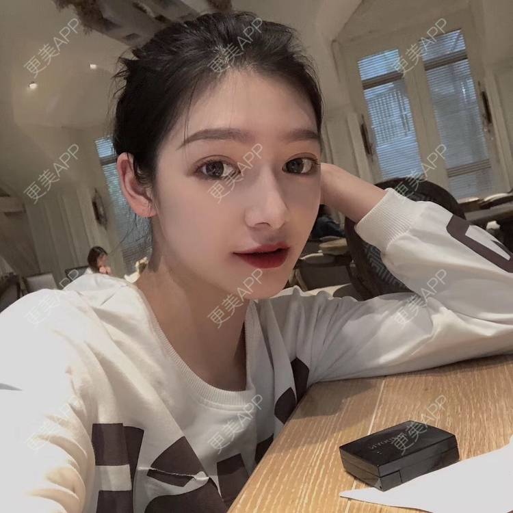 更美 - 直播听众朋友的鼻部多项经验 | 成都 | 视频日记 | 鼻部多项
